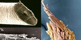 Макросъёмка тела человека: кожа, мышцы, кости… Человеческий волос под увеличением