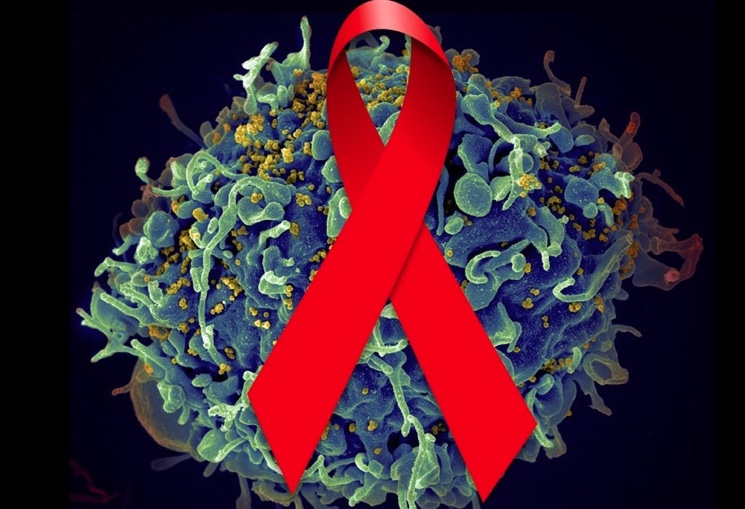 Что такое СПИД и как от него защититься