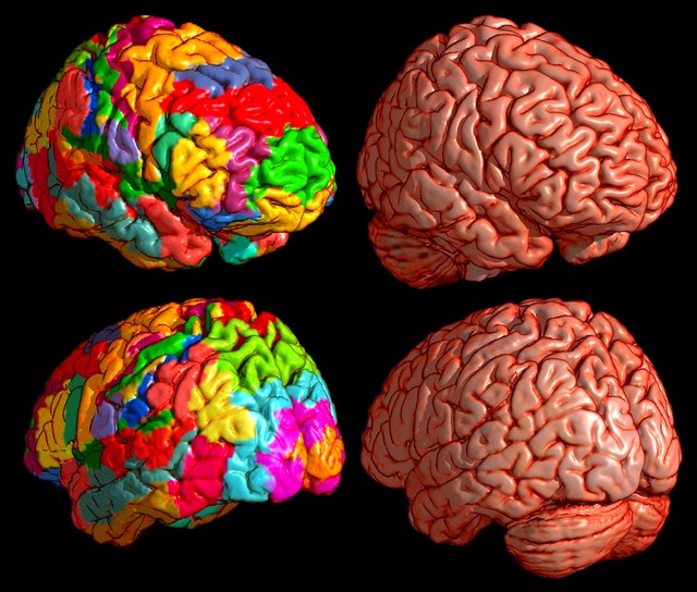 3d модели мозга человека