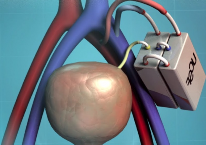 принцип работы искусственной почки