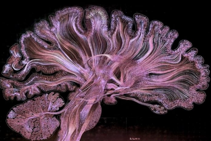 Общий вид головного мозга при микротравлении