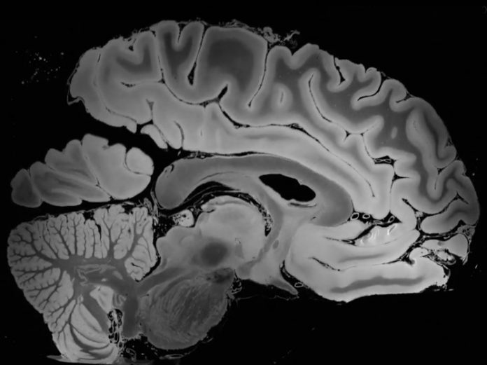 Получен снимок мозга самого высокого разрешения