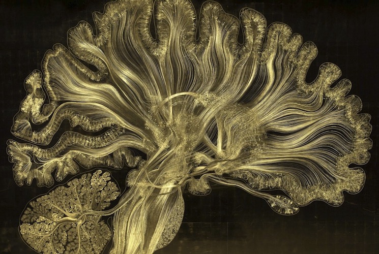 Снимки мозга методом электронного микротравление при белых лучах 