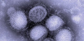 Вирус свиного гриппа
