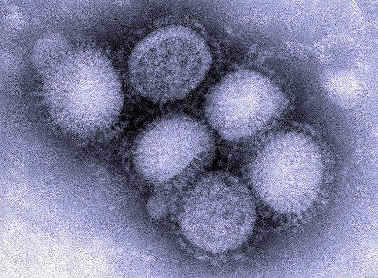 Вирус свиного гриппа