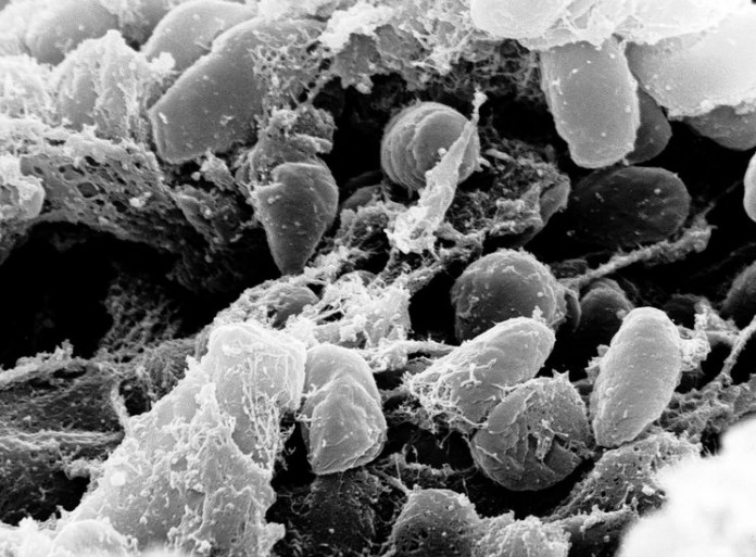 Чума - Yersinia pestis, увеличение ×2000